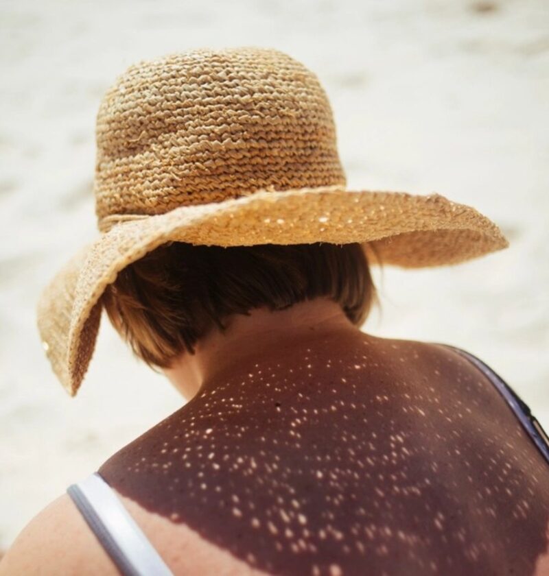 Femme au chapeau de paille sur la plage, épaules exposées au soleil
